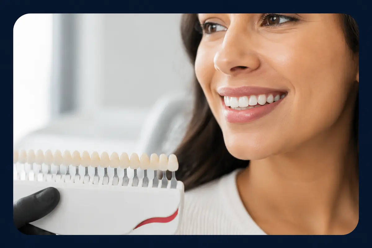 Natural smile assessment with a tooth shade guide